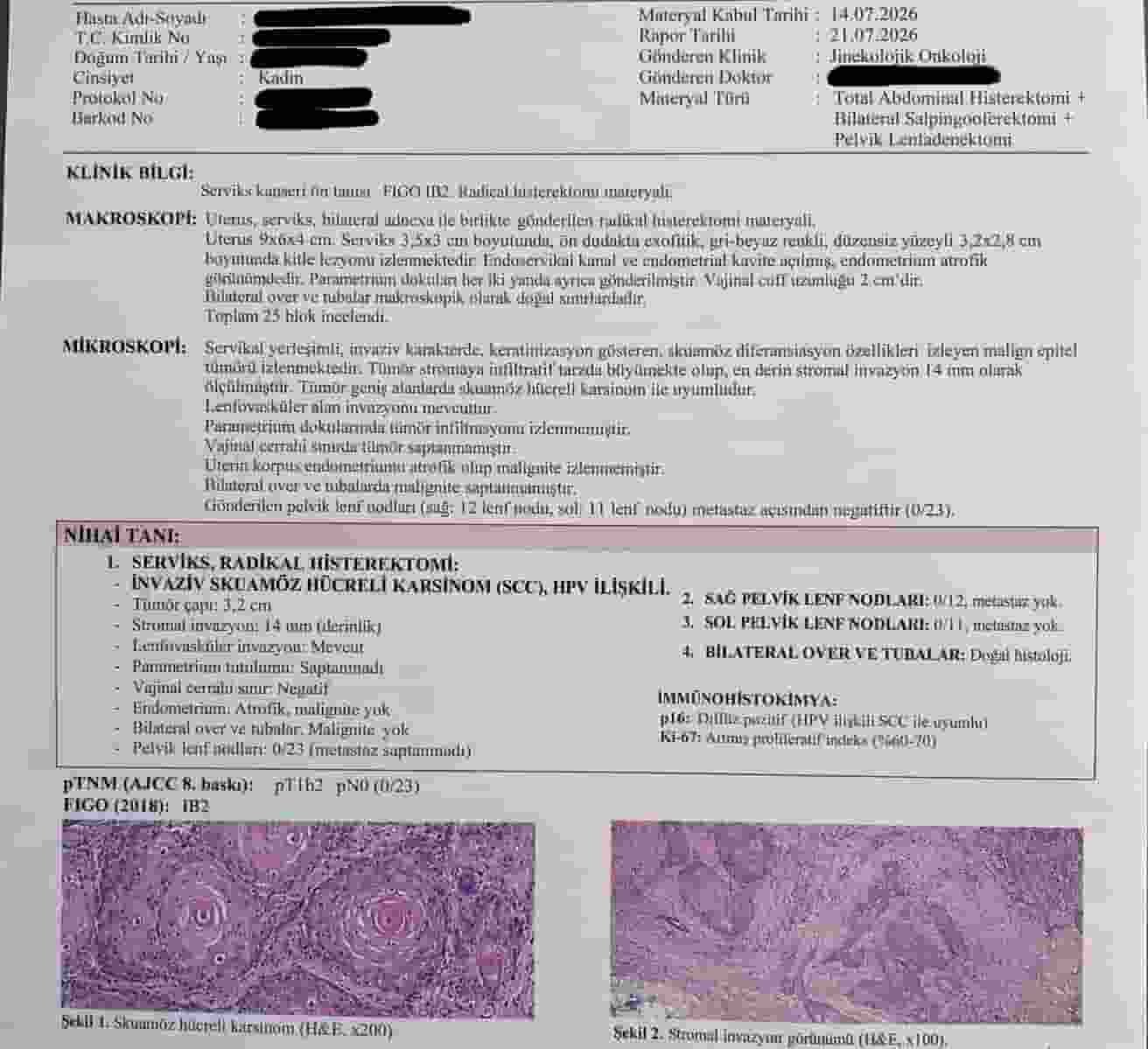 Rahim Alındıktan Sonra Patolojide Rahim Ağzı Kanseri Çıkarsa Ne Yapılır?